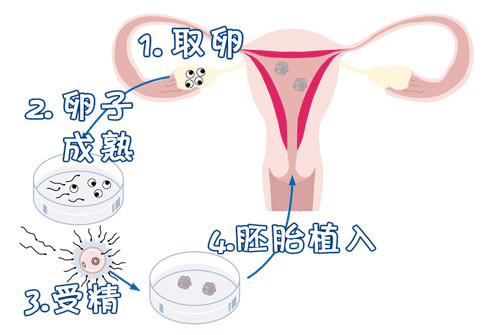 关于安悦佳妇产医院